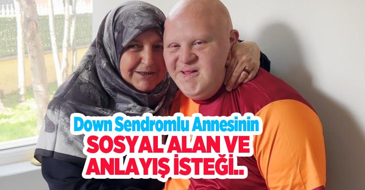 Down sendromlu annesinin sosyal alan ve anlayış isteği..