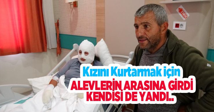 Kızını kurtarmak için alevlerin arasına girdi, kendisi de yandı..